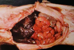 肠浆膜和肝脏表面覆盖着黄色纤维素.png